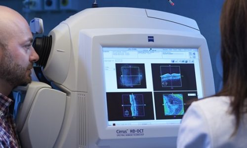 Oct tomografia radiazione ottica coerente